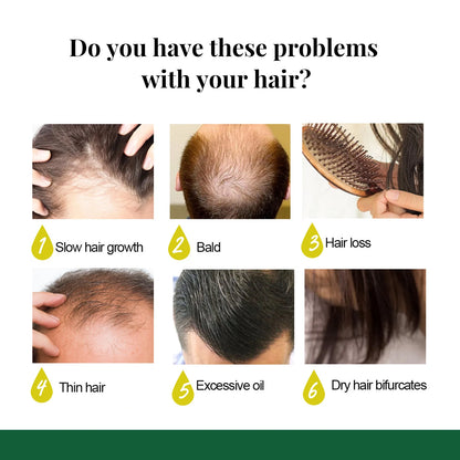 Ginger Oil Hair Booster Serum Spray Nourish Scalp Hair Follicles Refresh Control Oil Strengthen Hair Roots Nutrient Solution